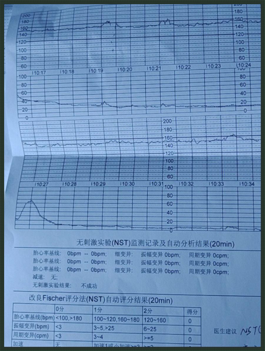 34周为什么不建议做四维彩超？