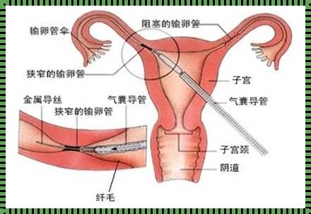 妇科检查输卵管怎么检查：揭开神秘的面纱