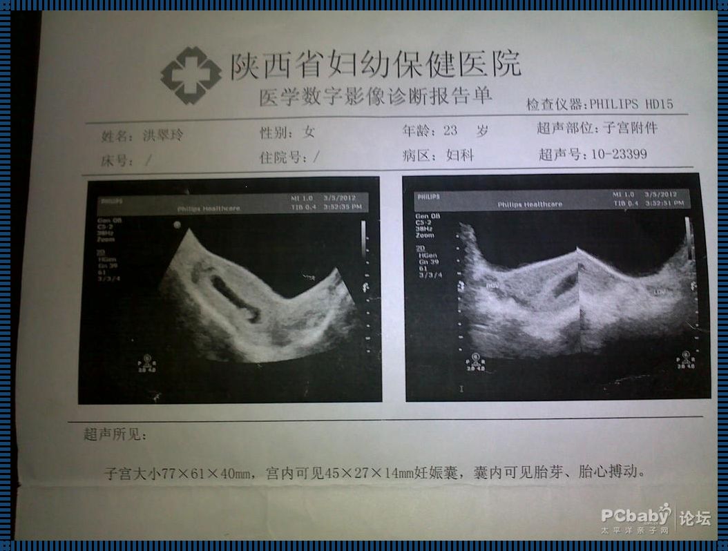 神秘的生命启示：怀孕多久可以看出来男女