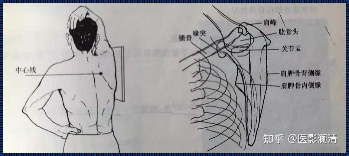 肩胛骨正侧位片怎么拍：深入解析与分享