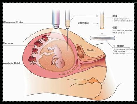 羊水穿刺大概几周做比较好