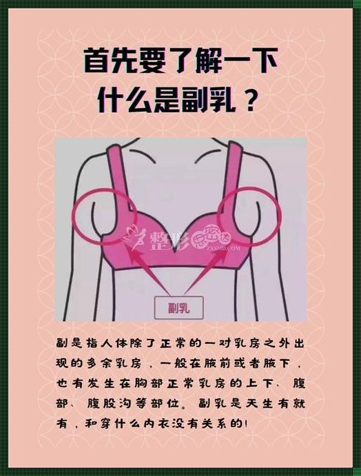 治疗腋下淋巴副乳：探寻解决之道