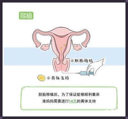 试管婴儿移植方法：深入了解这一现代生殖医学技术的整体过程