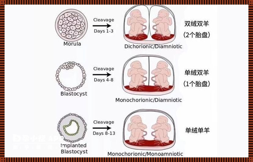 异卵双胞胎是什么意思