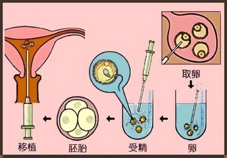 广州为什么那么多供卵？