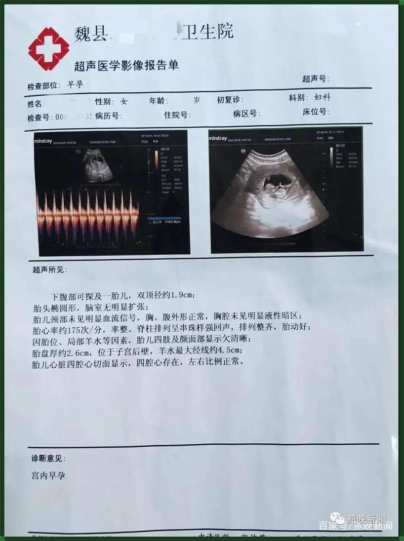 怎么去医院检查怀没怀孕：一次温馨的指南