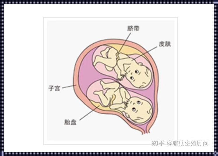 同卵和异卵哪个聪明？揭秘神秘的遗传密码