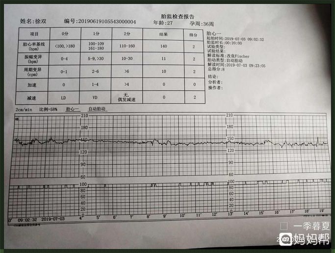 第一次胎心监护：一份温馨的提醒