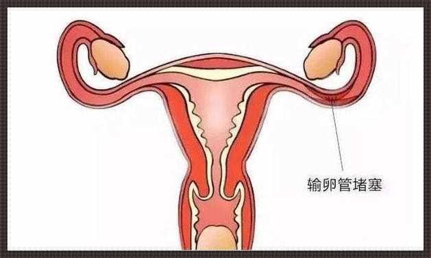 输卵管堵塞自己有感觉吗？深入解析带给你清晰答案