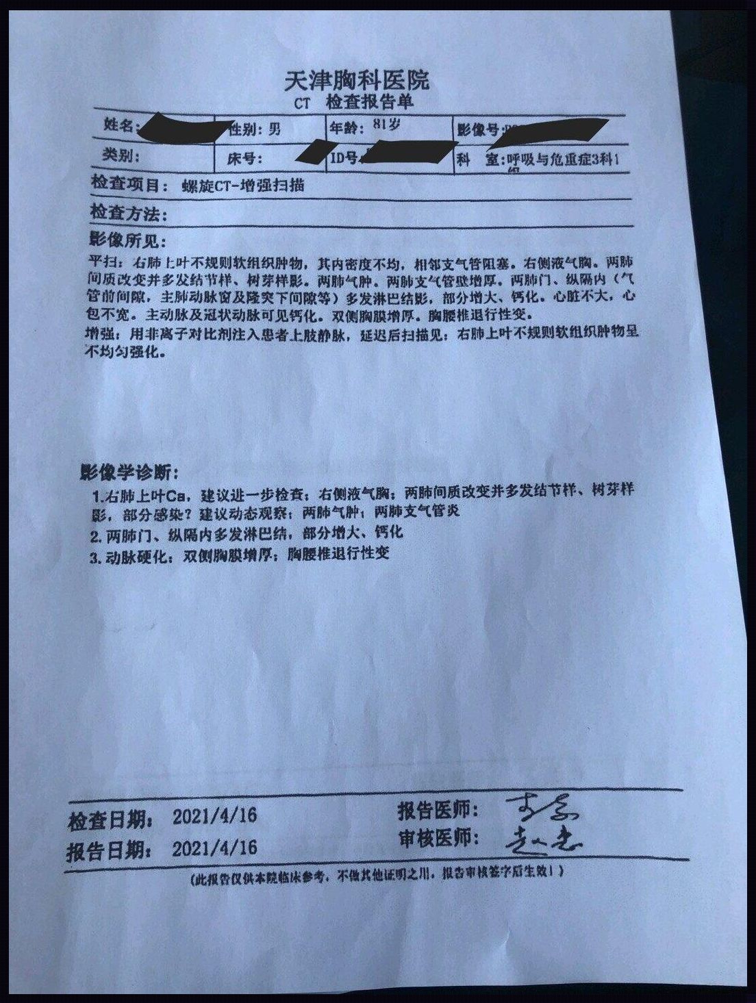 医生一看CT就说是肺癌：神秘面纱背后的真相