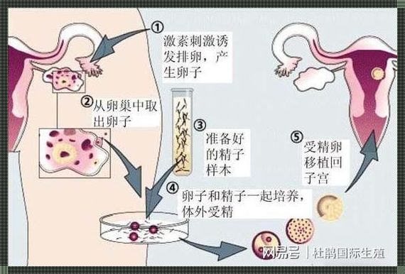 有没有人供卵生孩子的