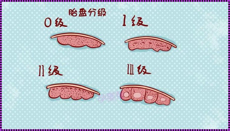 24周胎盘1级能保住吗：关于母婴健康的一个深入探讨