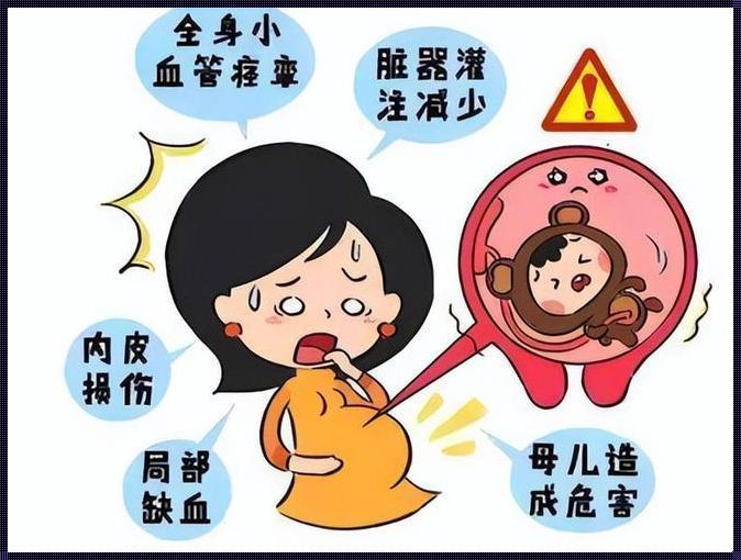 重度子痫前期一定要提前生吗？