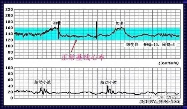 孕35周多久做一次胎心监护：关注宝宝的健康