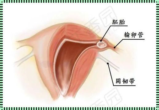 偏右侧宫角处怀孕怎么办？