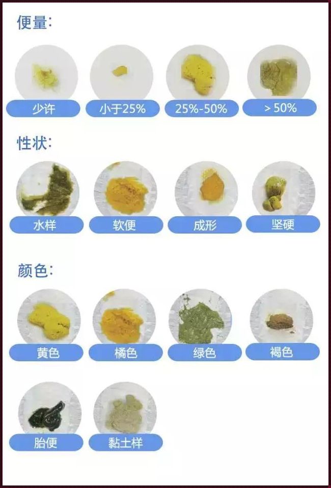 孕妇拉黑屎对胎儿有影响吗？深入探究与关爱