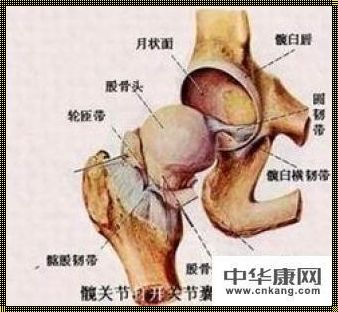 股骨头坏死是什么感觉