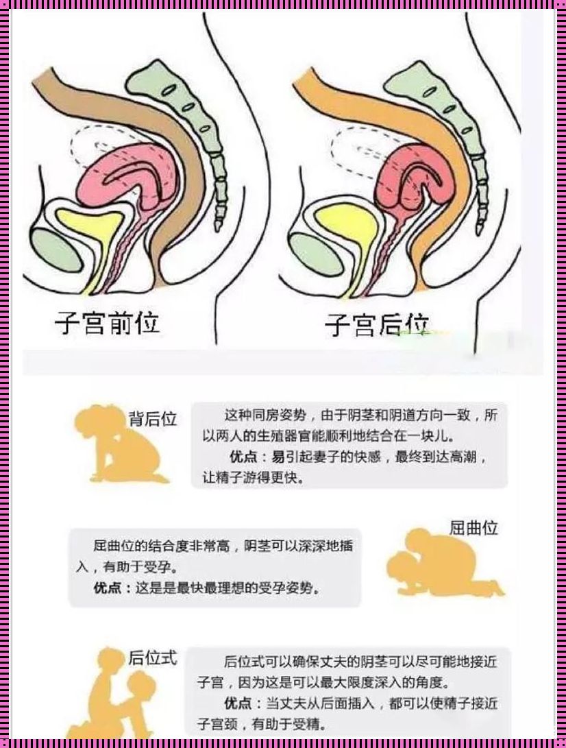 子宫后位最佳怀孕姿势