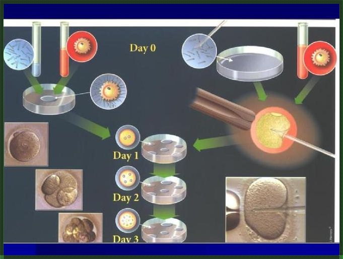 试管婴儿冻胚移植流程：从科研到生命的诞生