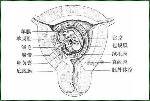 孕37周胎盘2级可以剖腹产吗