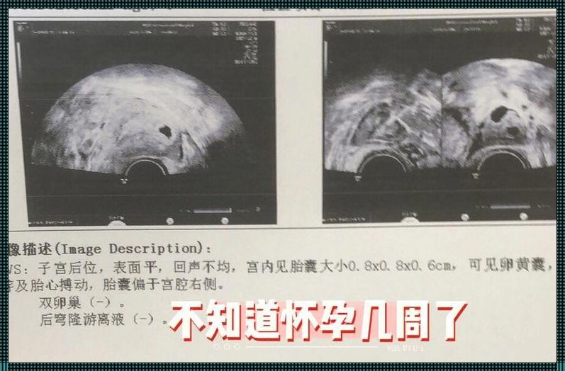 末次月经是指当月怀孕吗？深入解析背后的医学奥秘