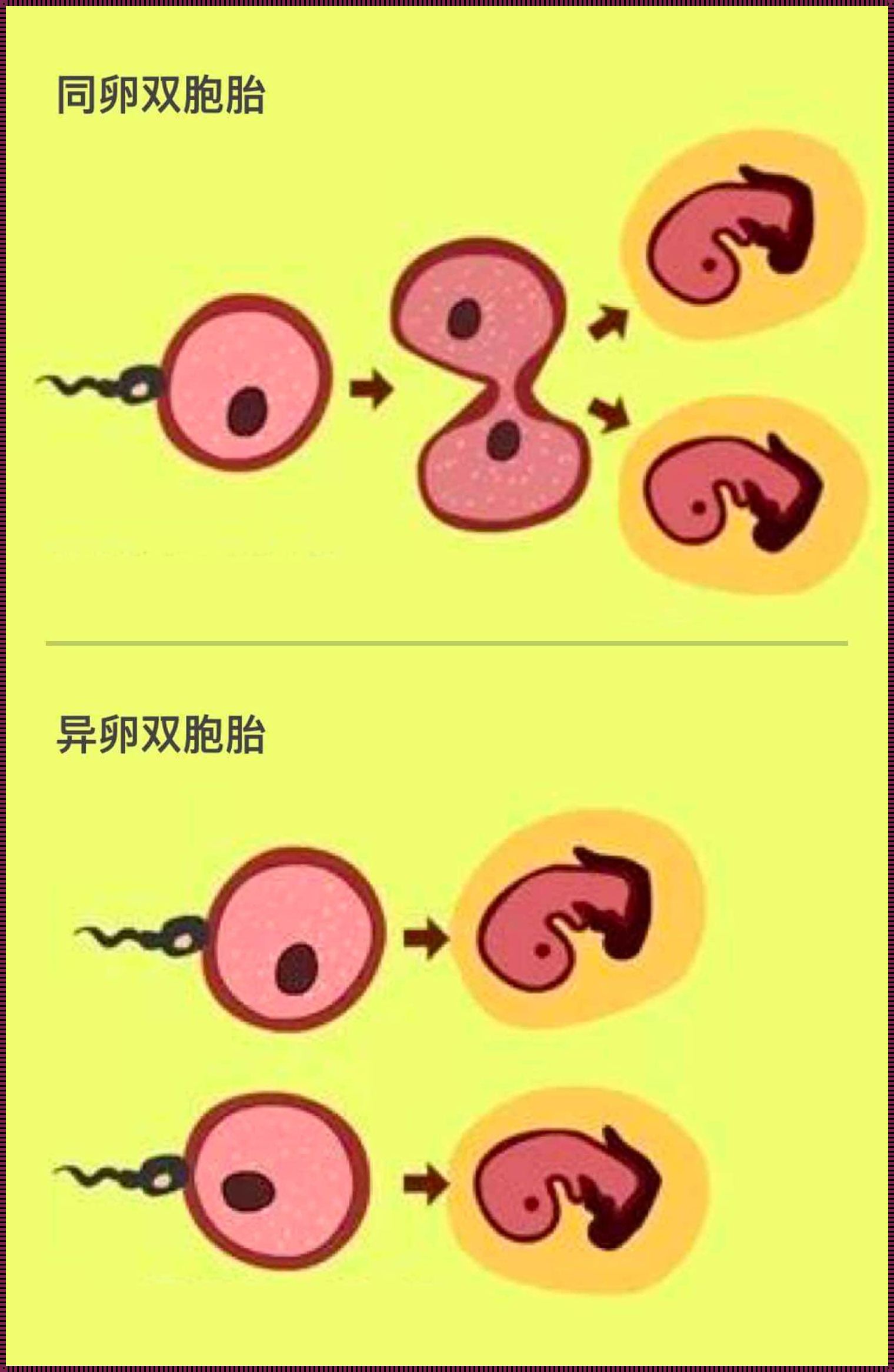 异卵双生基因型相同的概率：的概率探索