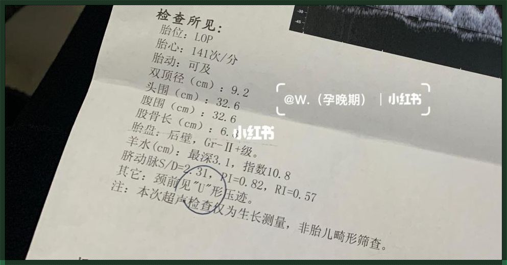 33周双顶径79会不会小头畸形