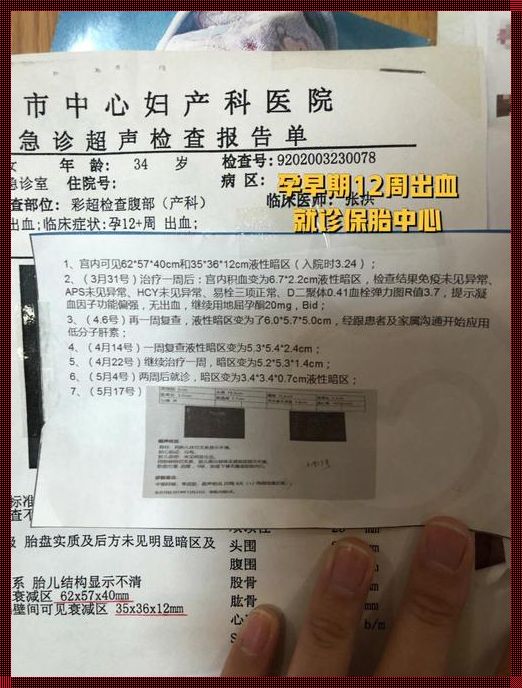 怀孕12周最佳流产需要几天