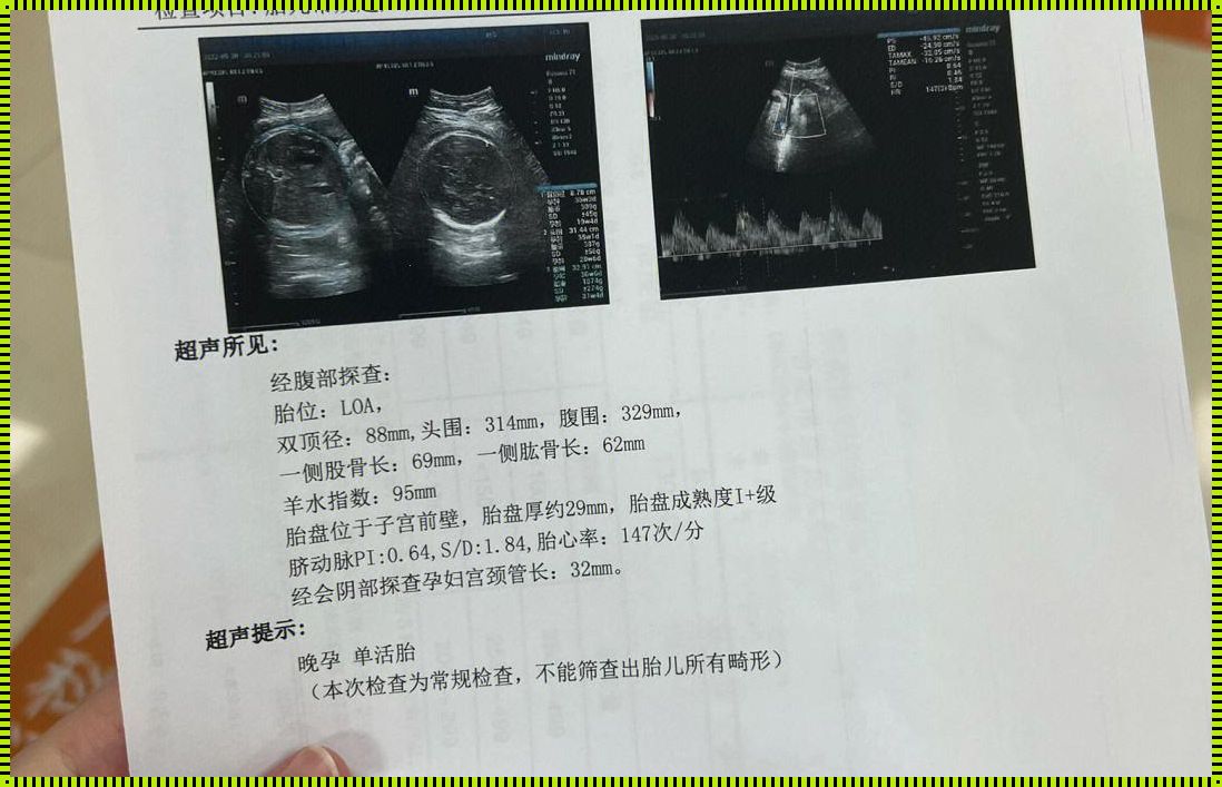 股骨长偏小四周已经生了：探讨儿童生长发育的疑难解答