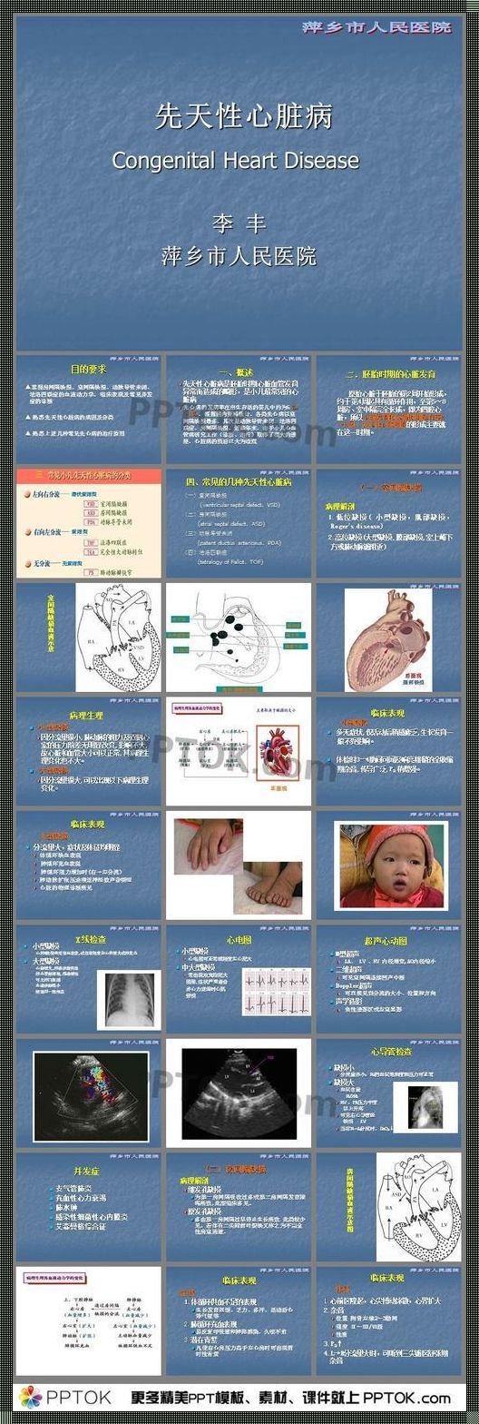 小儿先天性心脏病中最常见的是