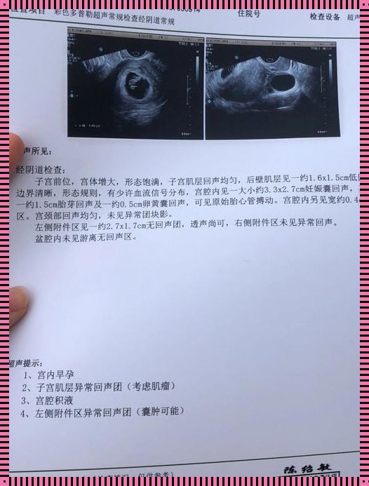 为什么刚怀孕就算3周了