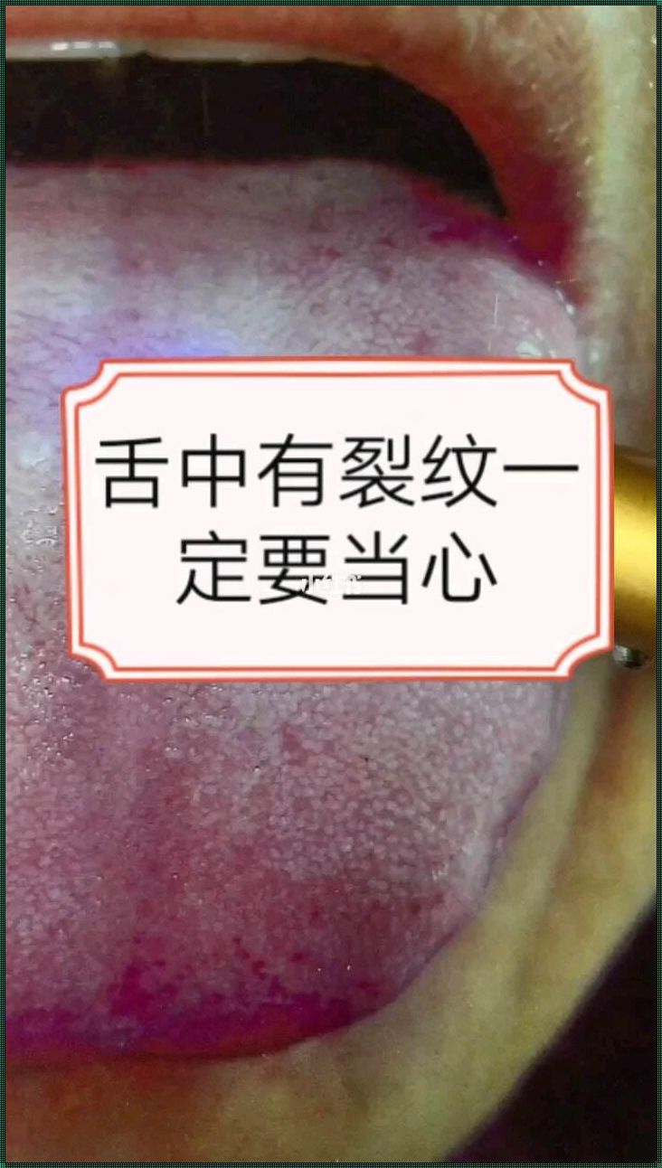 舌尖上的裂纹：揭秘背后的故事