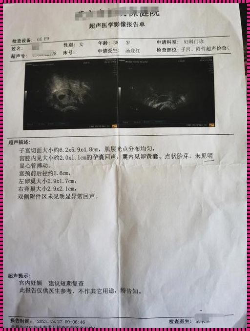 有卵黄囊胎停最大原因：深入探讨与分享