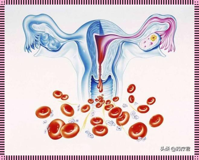 月经有血块像肉一样是怎么回事？