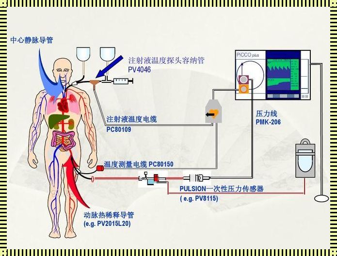 PICCO：静脉中的动脉，生命之源的守护者