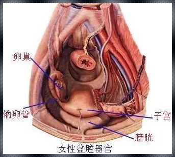 盆腔积液能不能排出来？深度解析与探讨