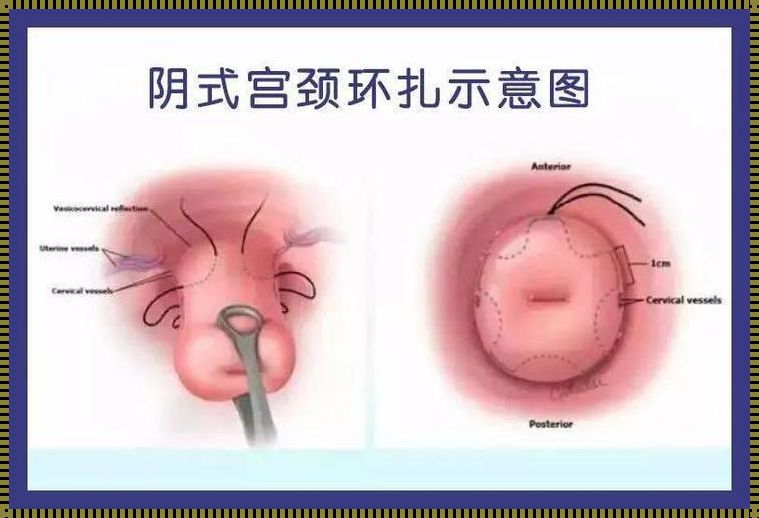 怀孕5个月流产对人体伤害大吗