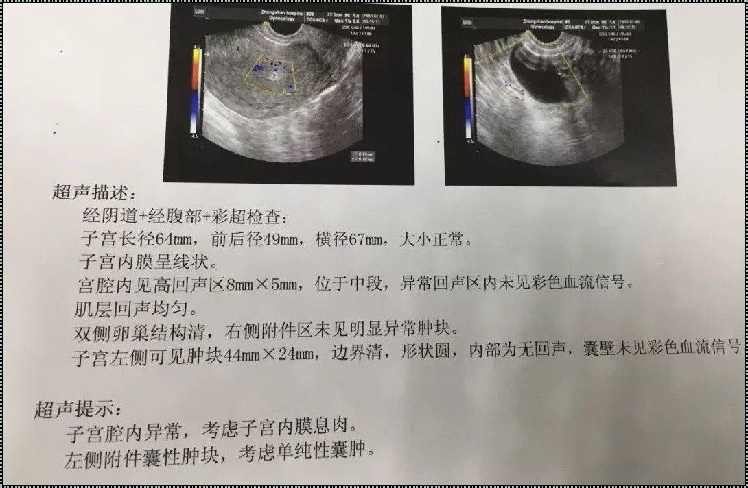 子宫横隔怀孕能有影响吗：深入解析与探讨