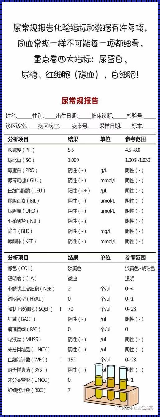 尿常规末端尿不准吗？平衡之道