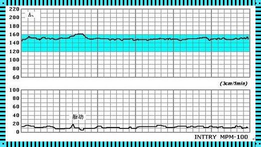 胎儿心电图范围：一项深入探讨