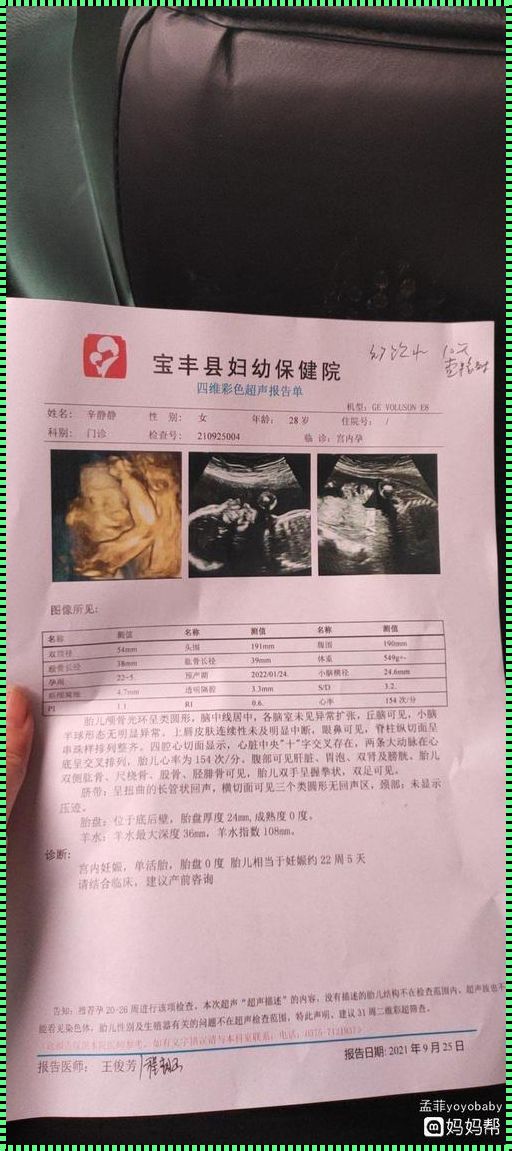 30周四维彩超单看男女：揭秘神秘面纱下的性别之谜