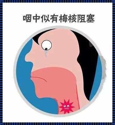 喉咙有梗阻感不影响吞咽：新品上市