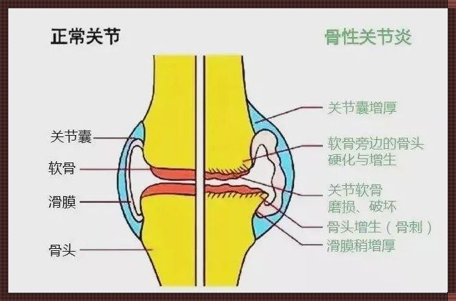 探索关节囊与韧带的关系：人体运动的神秘纽带