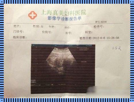 B超10周一般是实际怀孕多久