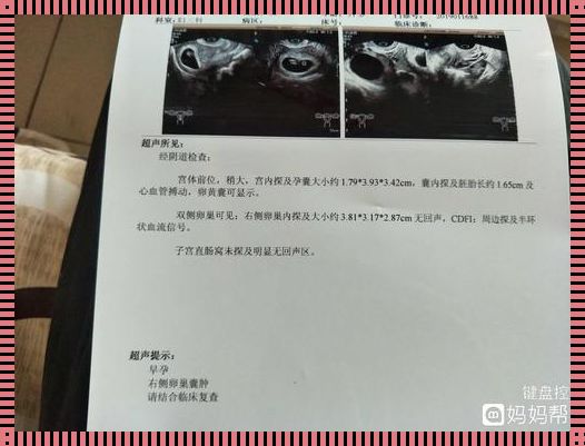 阴超可以检查出怀孕吗？揭秘神秘面纱下的真相