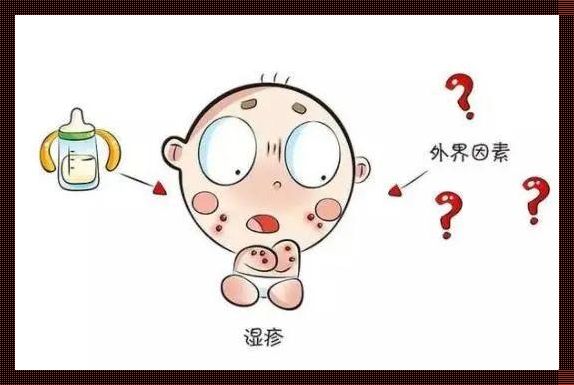 婴儿身上长湿疹是什么原因