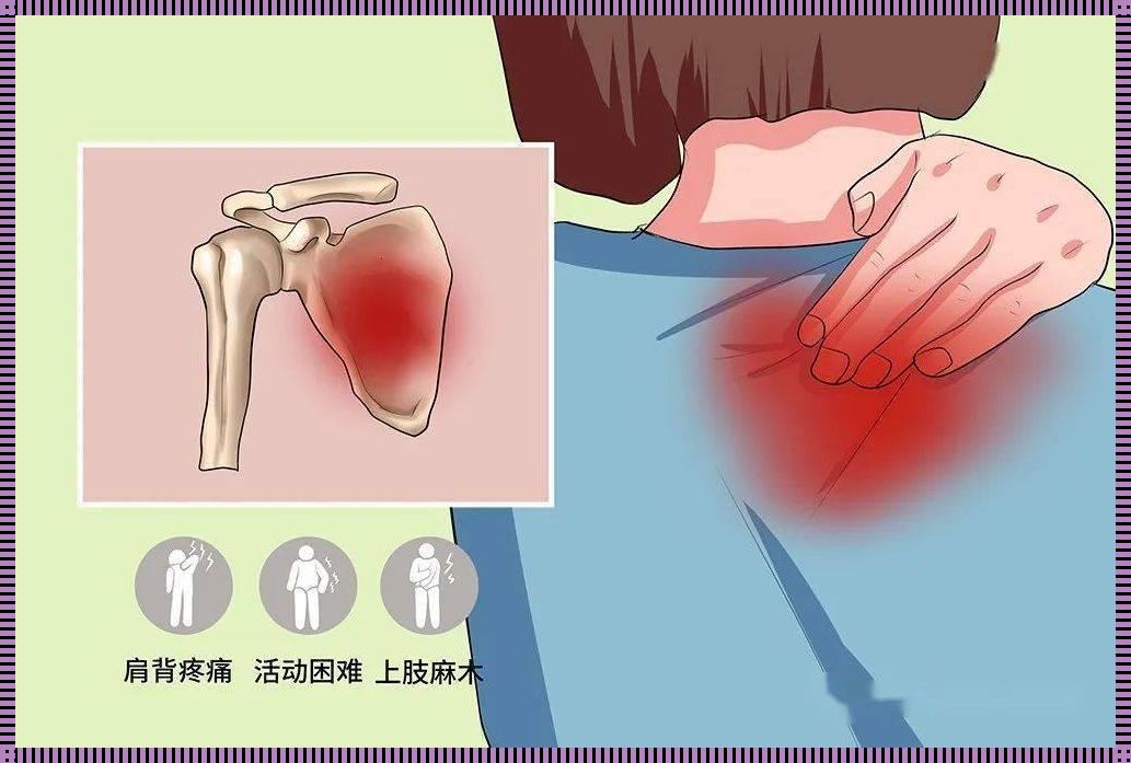 女人右肩胛骨疼的原因