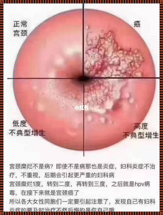 月经能否排出细菌炎症？探索月经的神秘功能