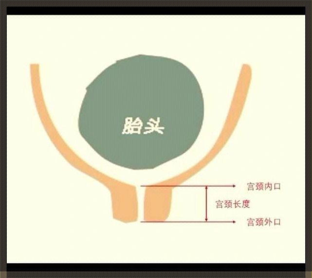 怀孕宫颈长度40mm正常吗？深度解析为读者揭秘