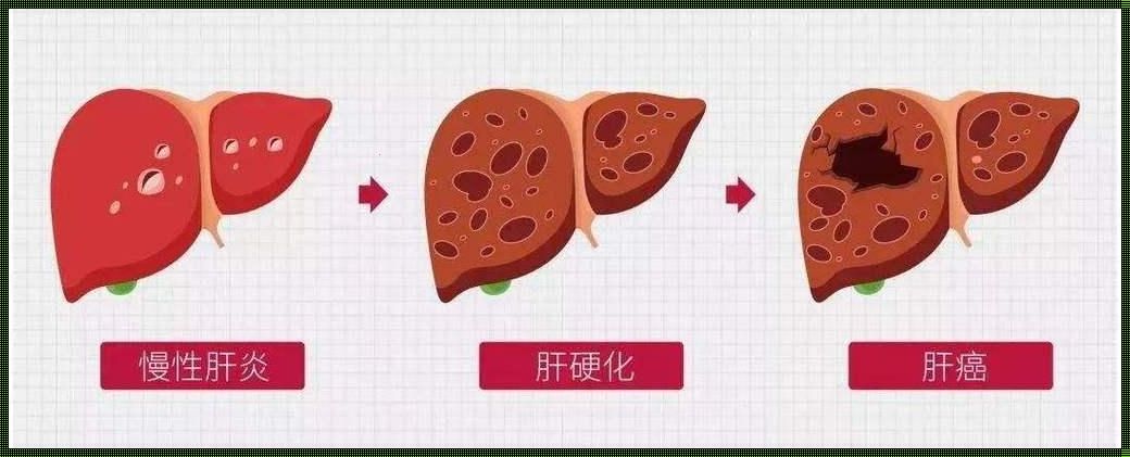 肝脏功能异常有什么症状：揭秘